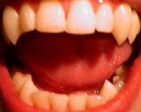 Dnash Vampire Fangs